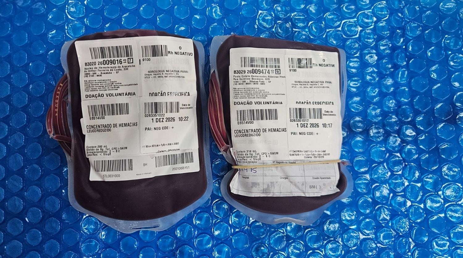 Bolsas de sangue raro chegam a Santa Catarina para atender paciente com anemia falciforme