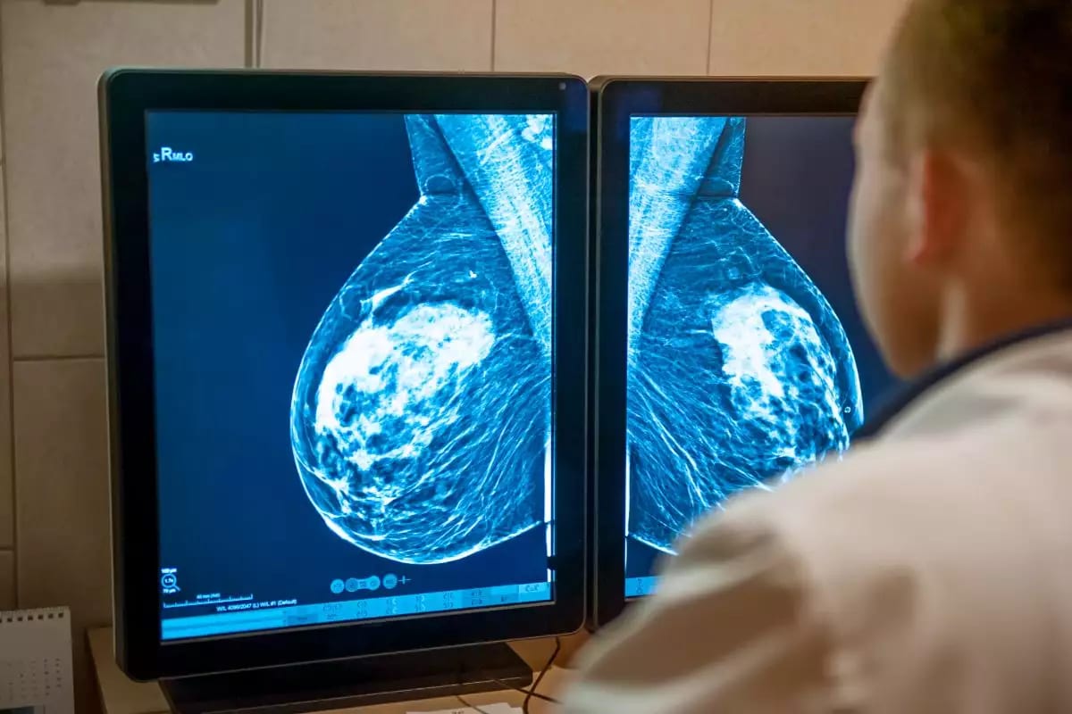 Outubro Rosa: cirurgias por câncer de mama crescem 26% na região de Marília