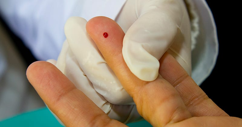 Pesquisa da USP liga internações por diabetes à vulnerabilidade em São Paulo
