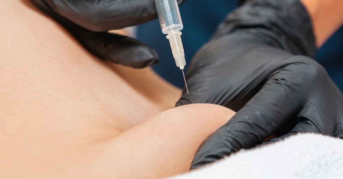 Injeção experimental promete reduzir gordura abdominal sem cirurgia e avança em testes