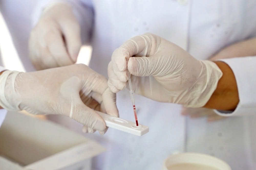 Brasil integra pesquisa internacional que busca a cura da hepatite B