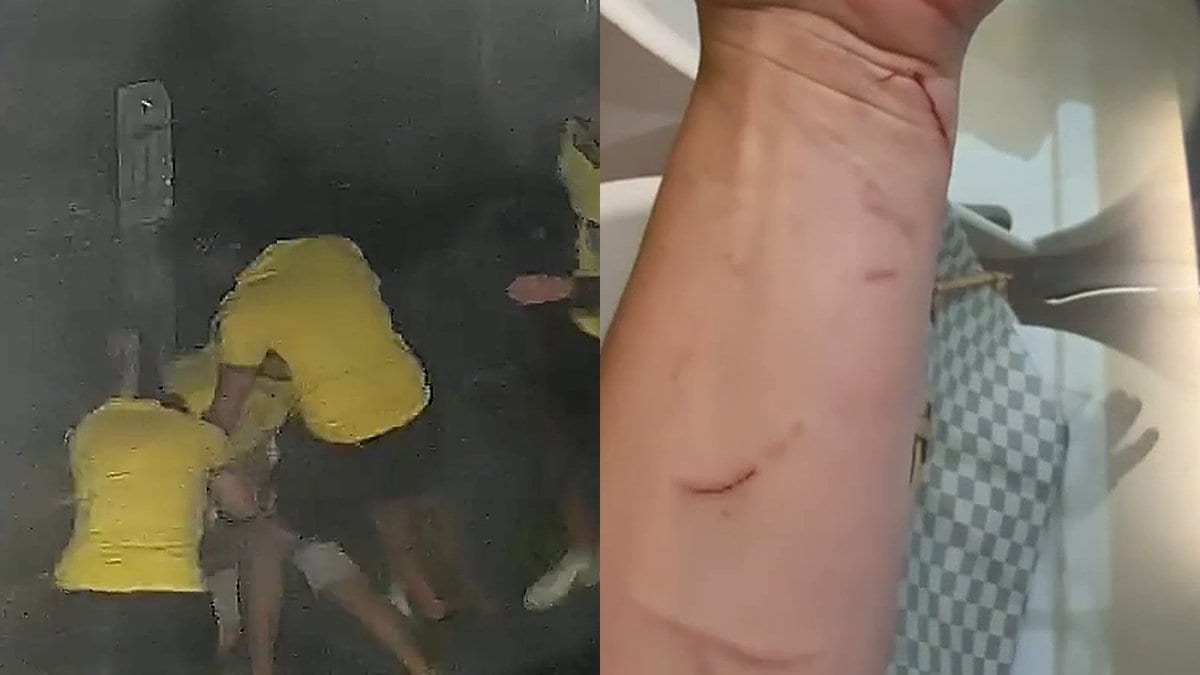 Petista que diz ter sido espancado por assessor de Jair Renan em Florianópolis invadiu terreno após vitória de Lula