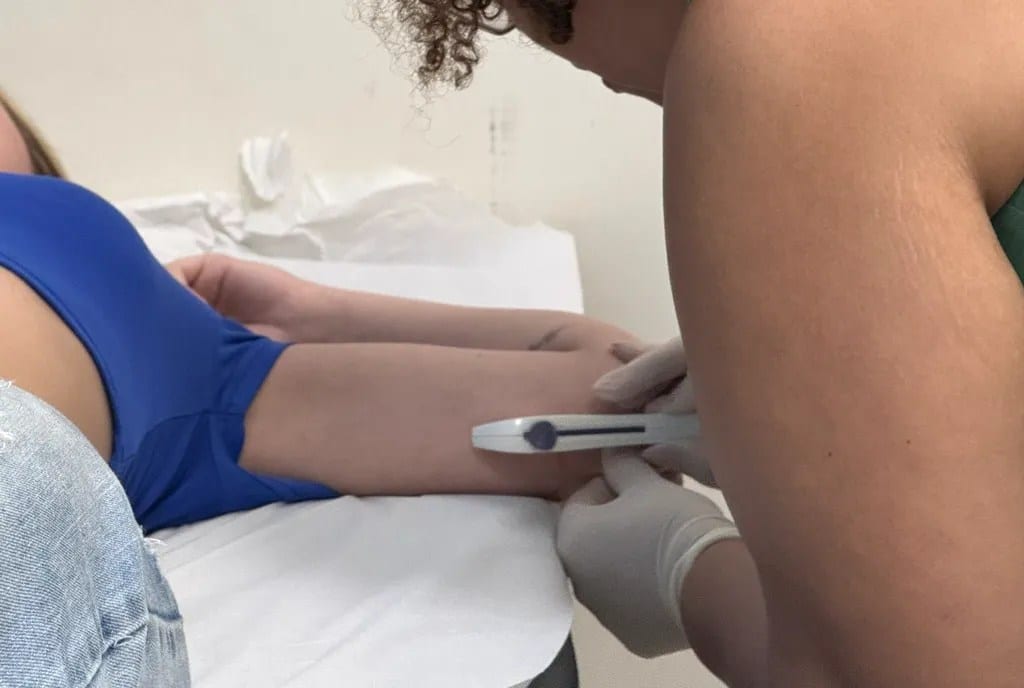 Mutirão de Implanon gratuito atende quase 900 mulheres em Americana