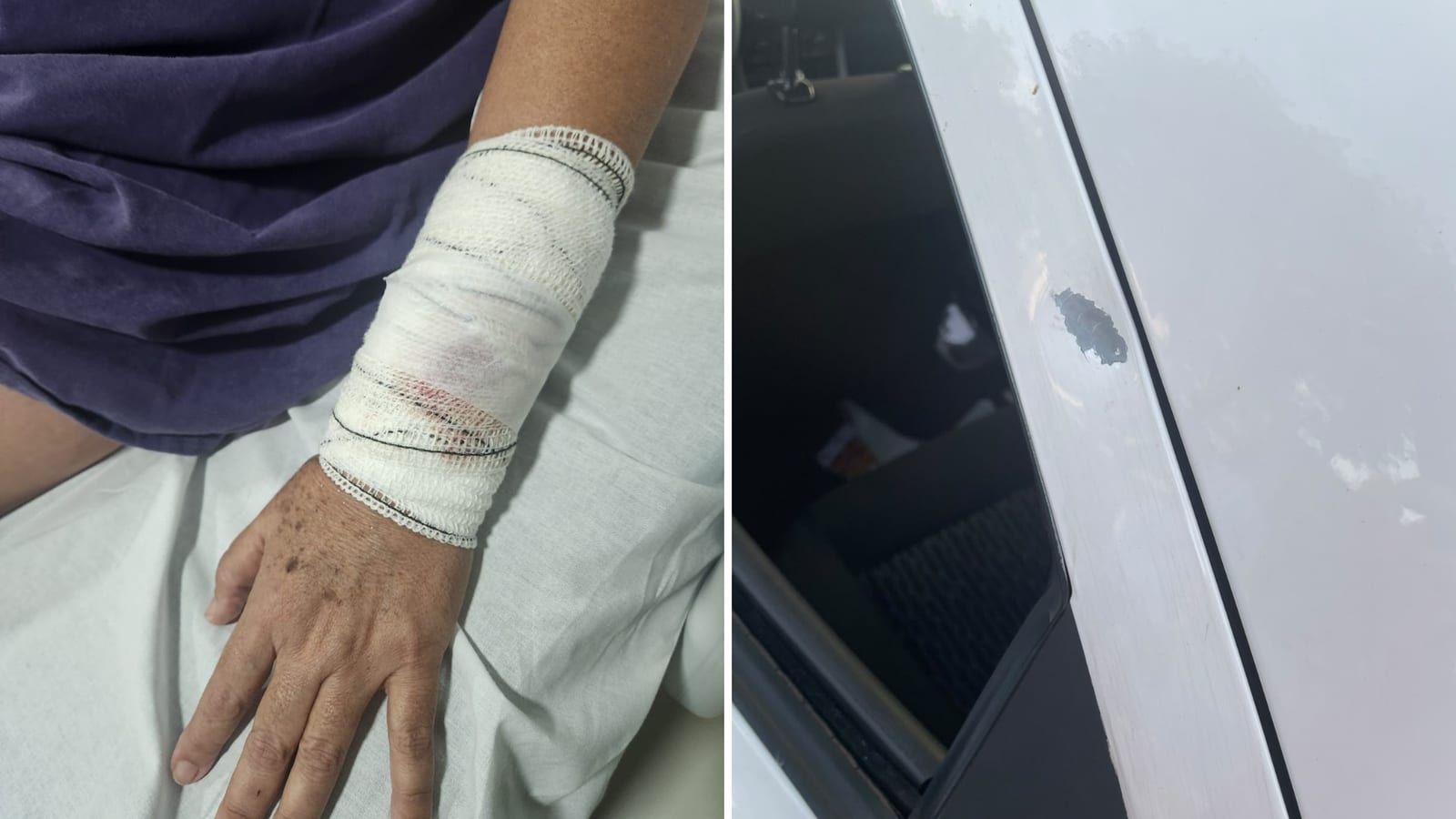 Mulher é atingida por tiro durante ato pró-Lula na Avenida Nações Unidas em Bauru