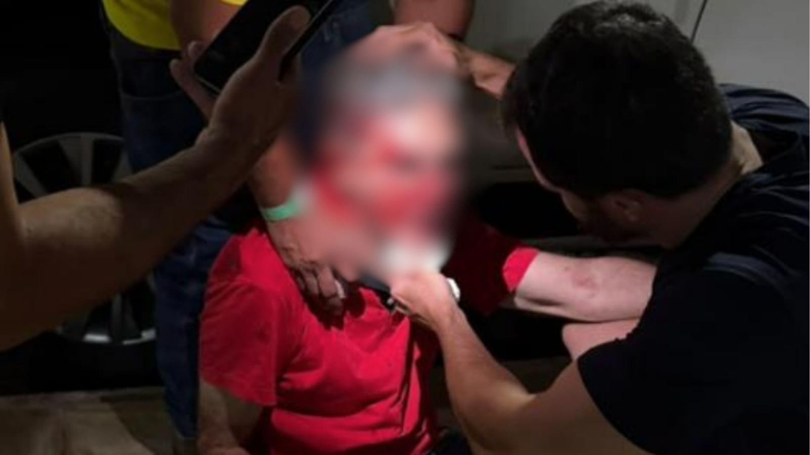 Pastor agredido por usar camiseta vermelha em Goiânia terá que fazer cirurgia