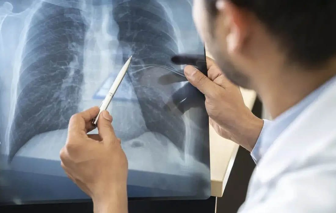 Tabagismo é maior entre jovens de 16 a 24 anos, alerta pesquisa