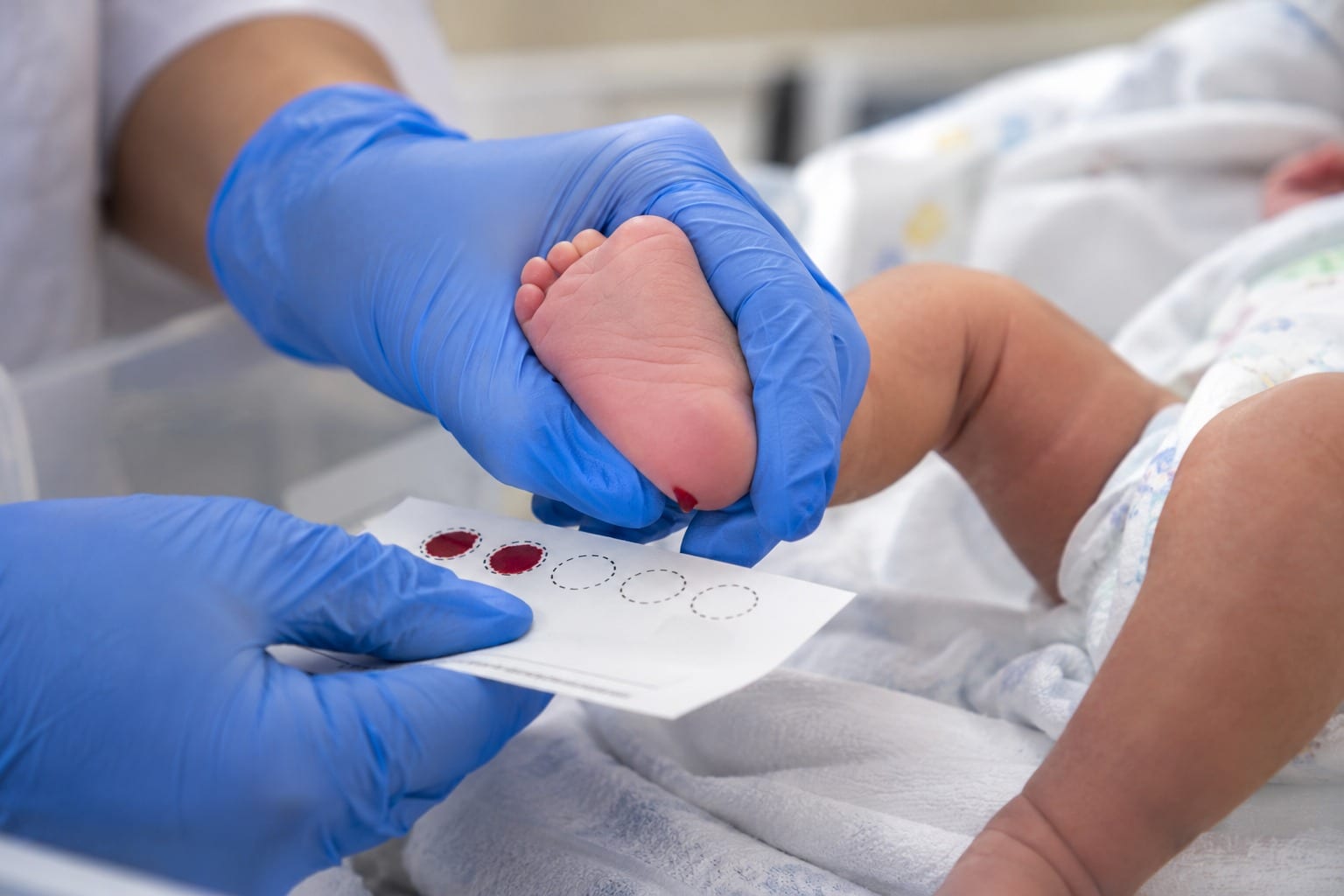Doença falciforme: diagnóstico precoce e tratamento garantem mais qualidade de vida aos pacientes