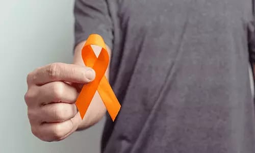 Prefeitura de Fernandópolis institui a campanha "Junho Laranja" para prevenir acidentes com queimaduras