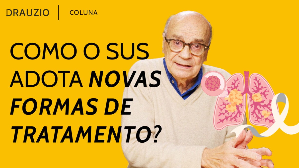 Como novos tratamentos para câncer de pulmão podem chegar ao SUS?