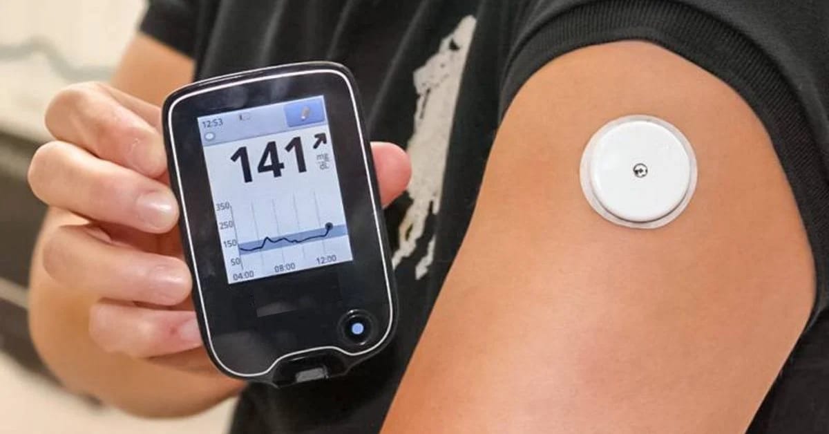 Santa Maria inicia capacitação para uso de sensores de glicose, com investimento de R$ 1,8 milhão