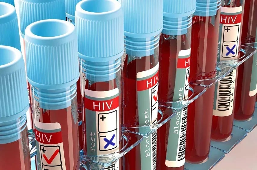 84% dos diagnósticos tardios de HIV foram em heterossexuais, diz estudo