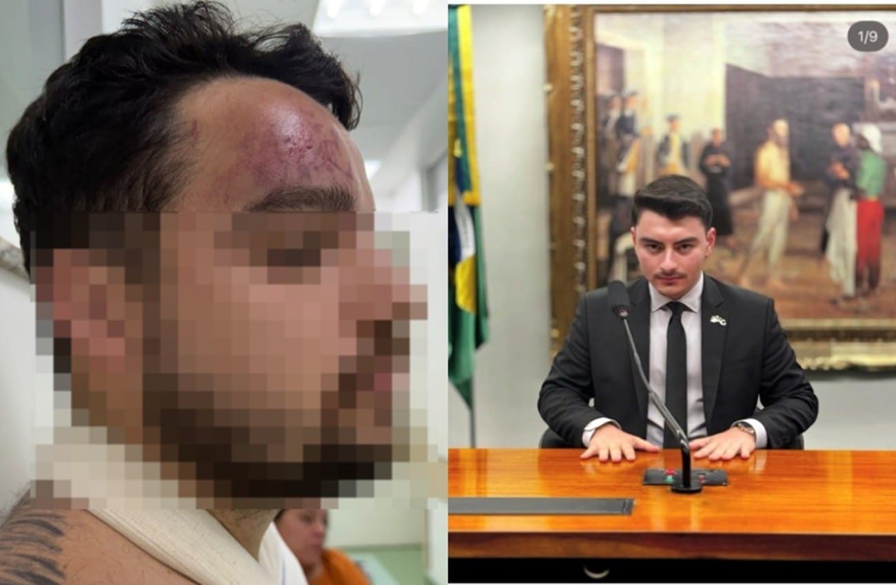 Assessor de Jair Renan é investigado por agredir primo com garrafadas na cabeça após vitória de Lula