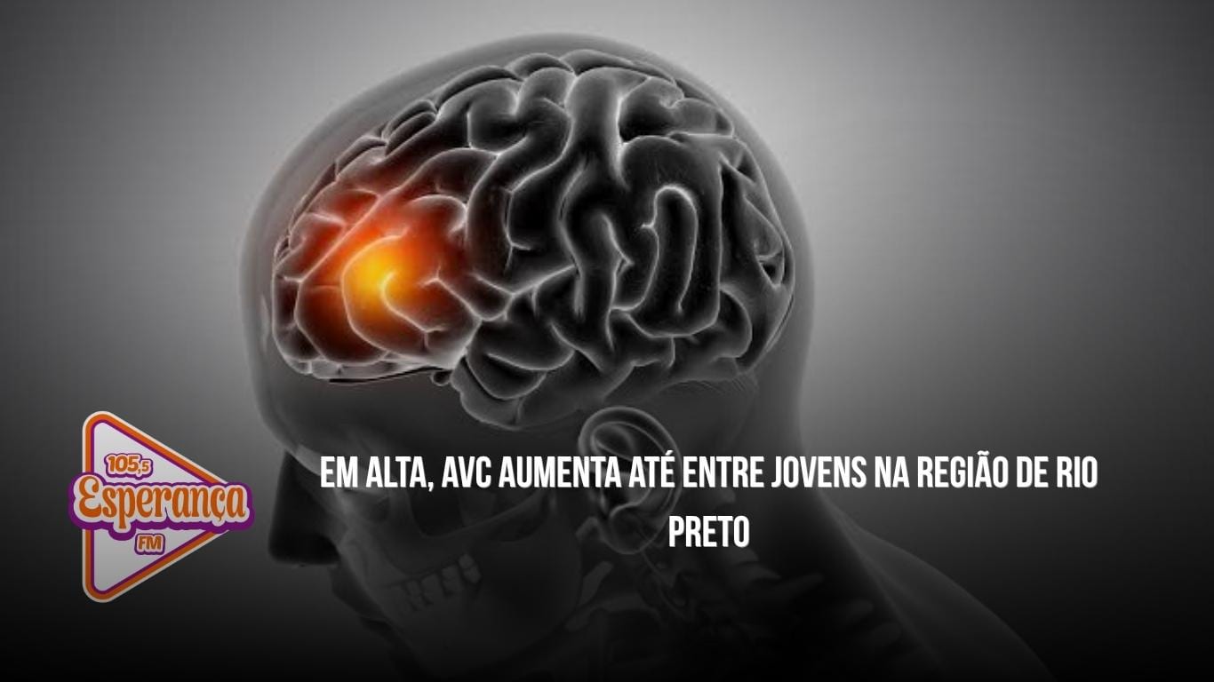 Em alta, AVC aumenta até entre jovens na região de Rio Preto