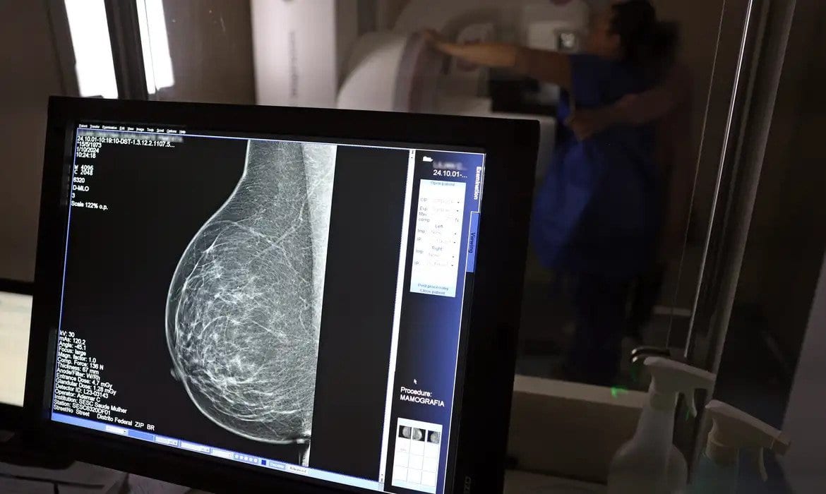 Prefeitura de São Leopoldo deve retomar realização de mamografias pelo SUS
