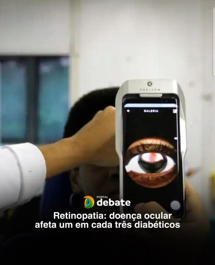 Uma em cada três pessoas com diabetes no Brasil desenvolverá, em algum momento da vida, retinopatia diabética – uma das